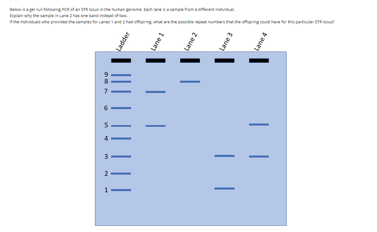 Solved Below is a gel run following PCR of an STR locus in | Chegg.com