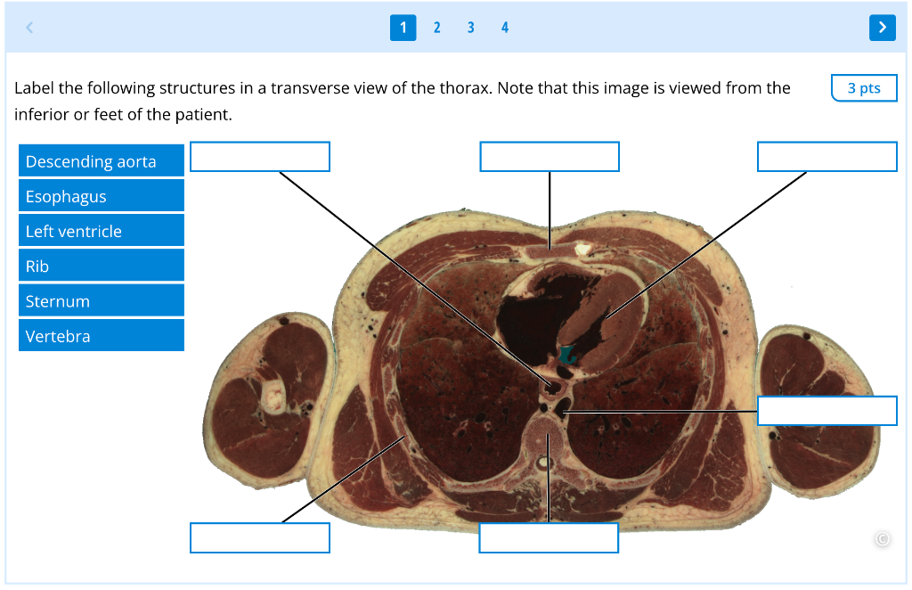 Label the following structures in a transverse view of the thorax. Note that this image is viewed from the inferior or feet o