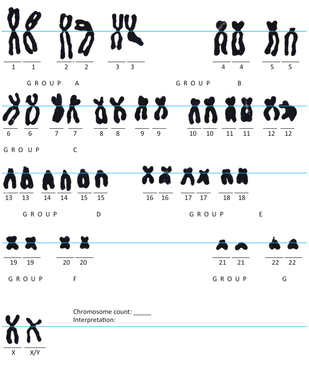 Solved Photographs Of The Somatic Chromosomes Of An 2522