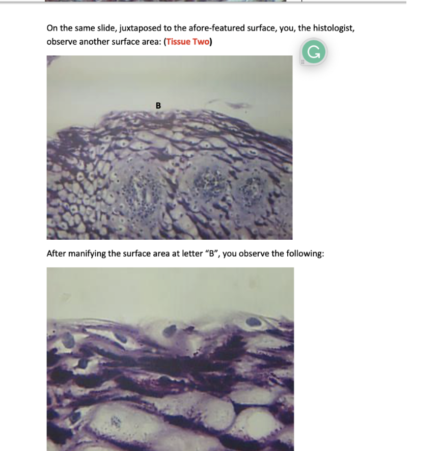 On the same slide, juxtaposed to the afore-featured surface, you, the histologist, observe another surface area: (Tissue Two)