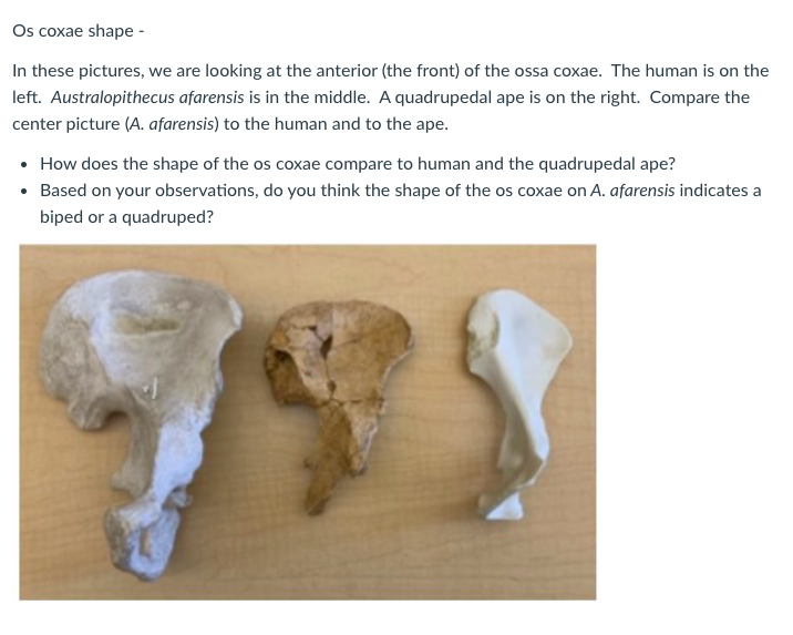Os coxae shape - In these pictures, we are looking at | Chegg.com