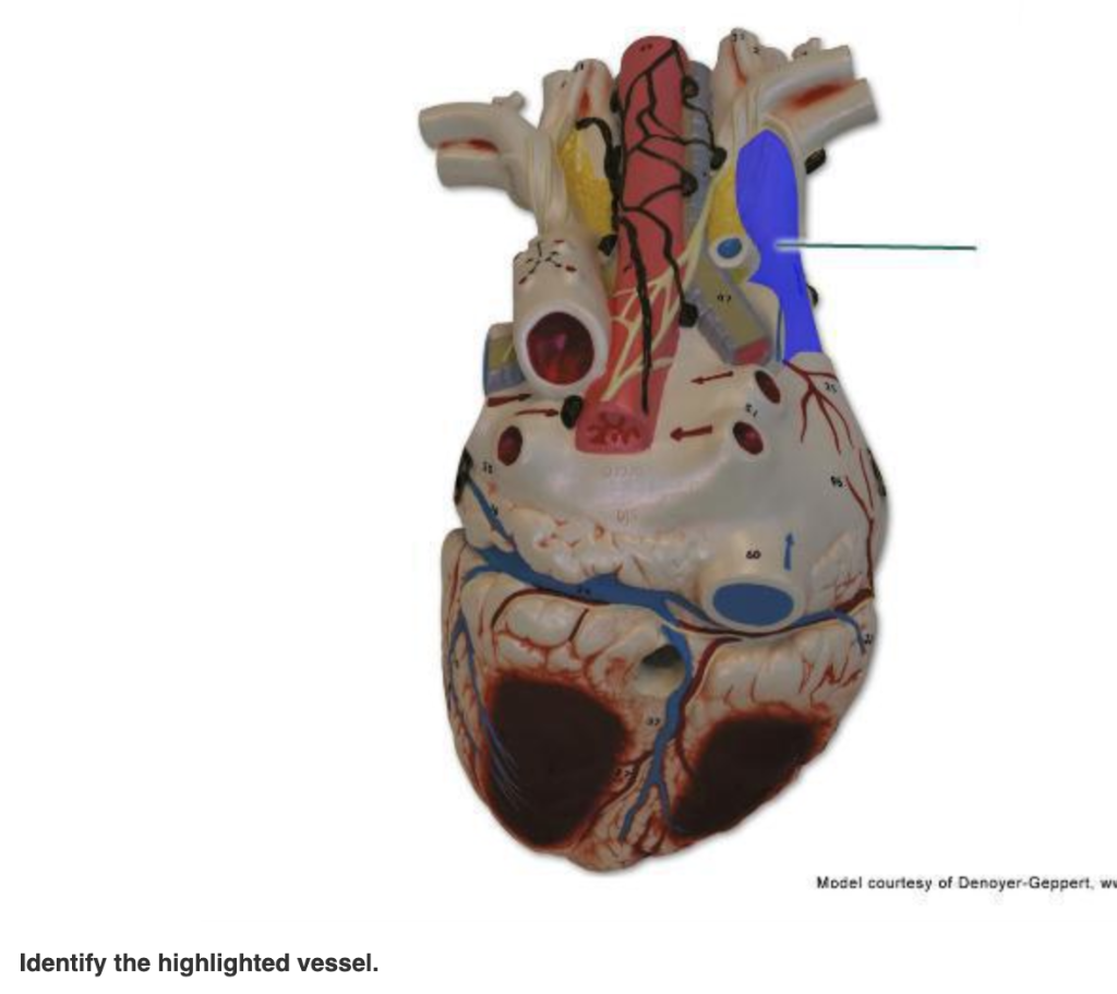 Solved Identify the highlighted vessel. Model courtesy of