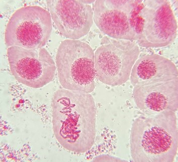 Solved mitosis experiment, stained chromosome of the onion | Chegg.com