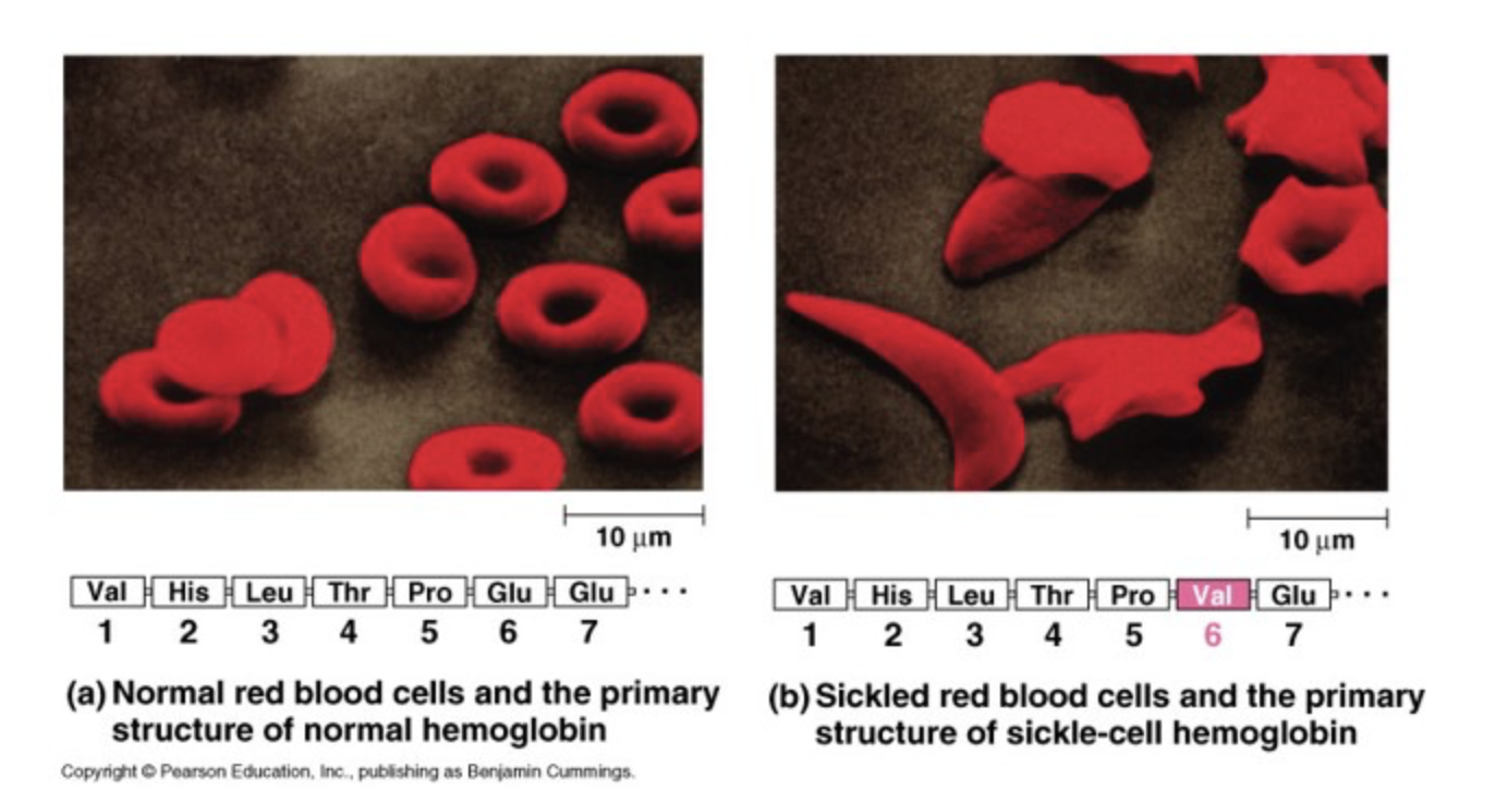 Solved (a) Normal red blood cells and the primary (b) | Chegg.com