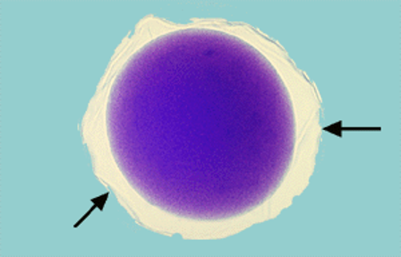 Solved Stages in starfish Development please label the | Chegg.com