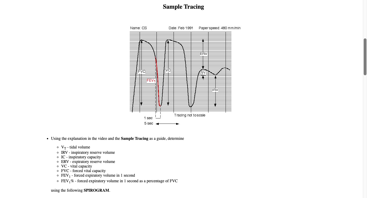 Sample Tracing
- Using the explanation in the video and the Sample Tracing as a guide, determine
- \( \mathrm{V}_{\mathrm{T}}