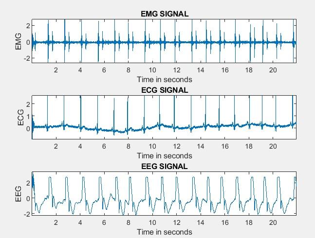Solved What are the three biomedical signals shown in the | Chegg.com