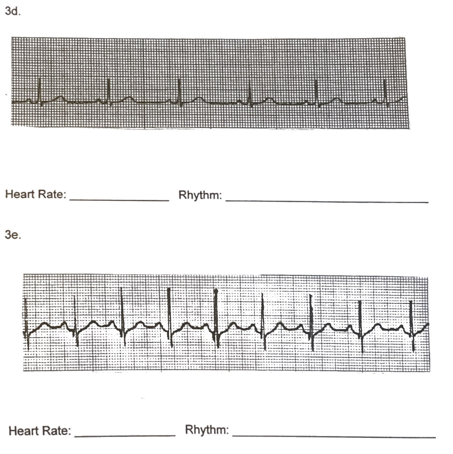 Solved for each of them, find the heart rate and rhythm. | Chegg.com