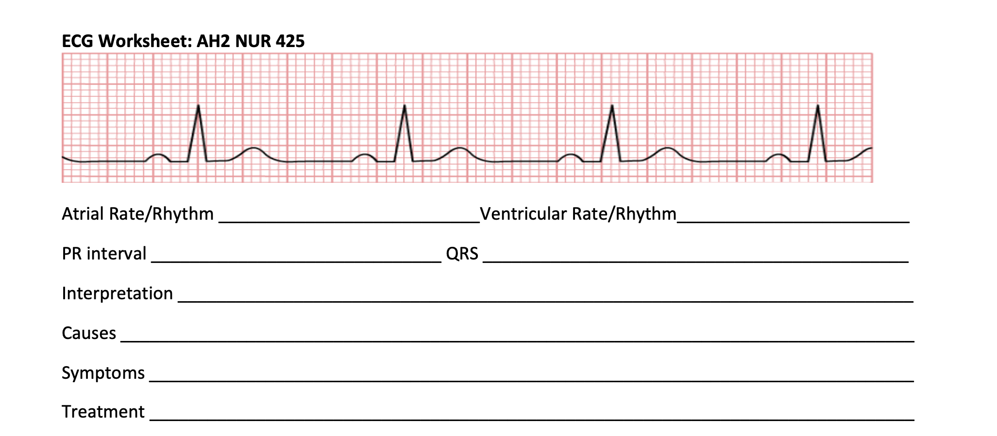 Solved ECG Worksheet: AH2 NUR 425 u M u Atrial Rate/Rhythm | Chegg.com