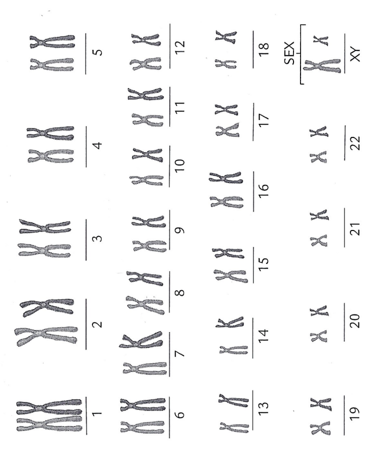 Solved Xx Xxx Xk 2xx5xx 6xk7xk3xk98k10xk11xk128k