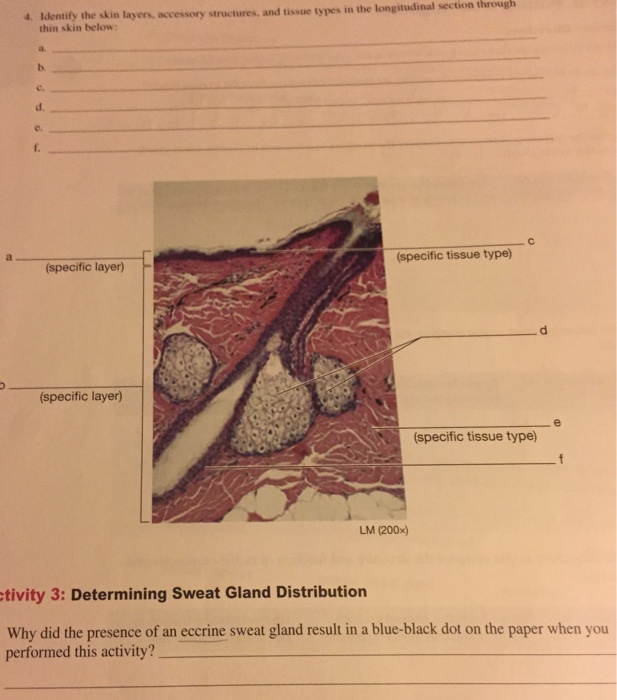 Solved 4. Identif y the skin layers, accessory structures,