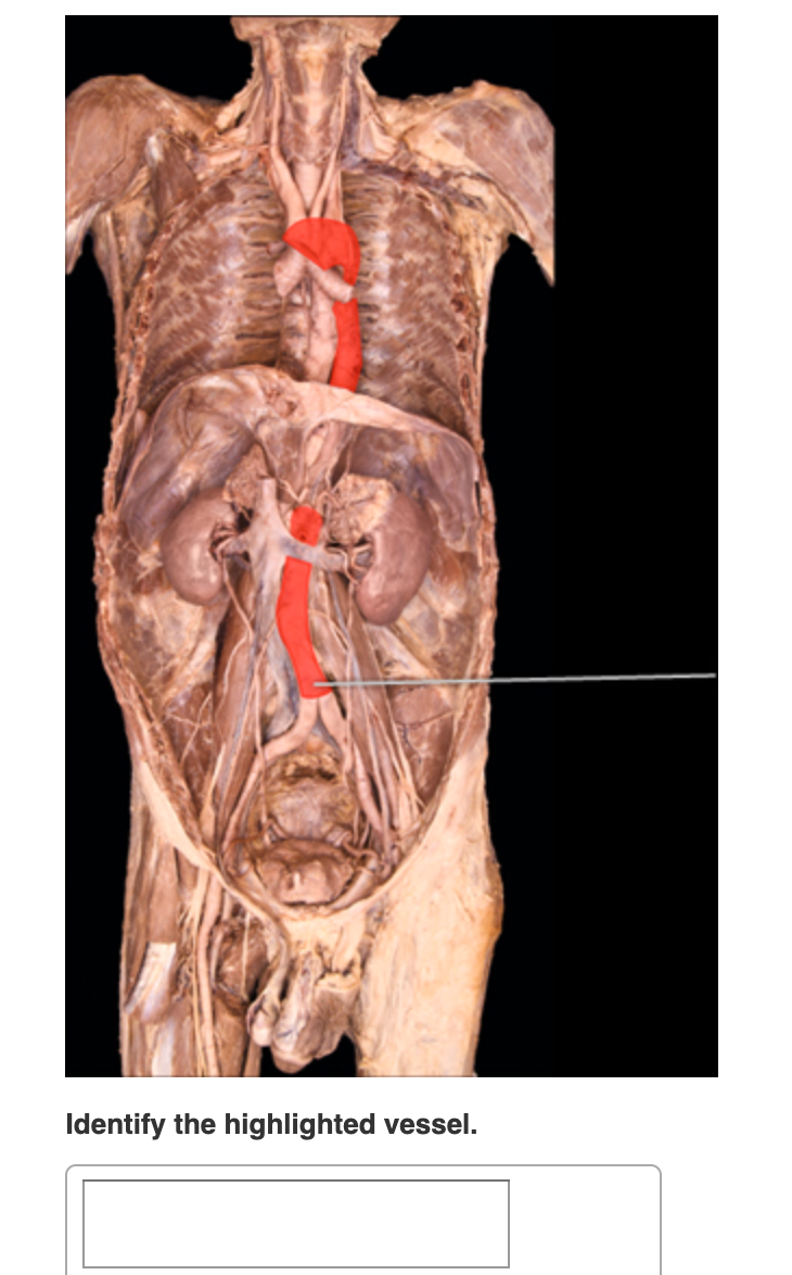 Lt G12 Giant Identify The Highlighted Vessel Left Chegg Com