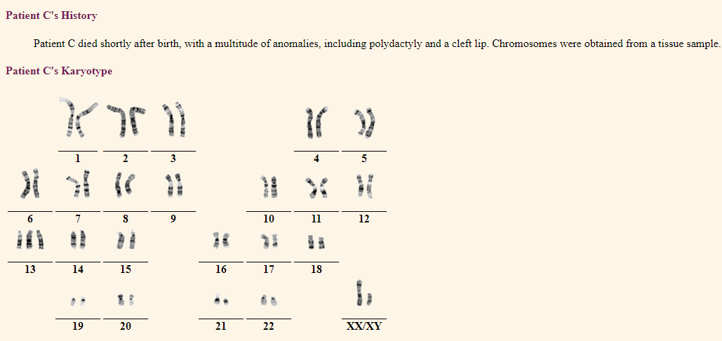 Solved Interpreting The Karyotype Lab Technicians Compile | Chegg.com