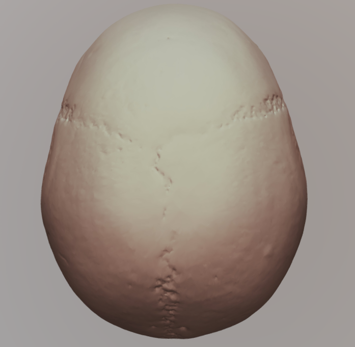 Solved Left Right Adult Age Estimation from Cranial Suture | Chegg.com