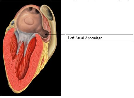 The left atrial appendage in the heart is a region in | Chegg.com