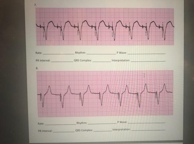 Rate: Phythm: P Wave: PR Interval: QAS Complex: | Chegg.com