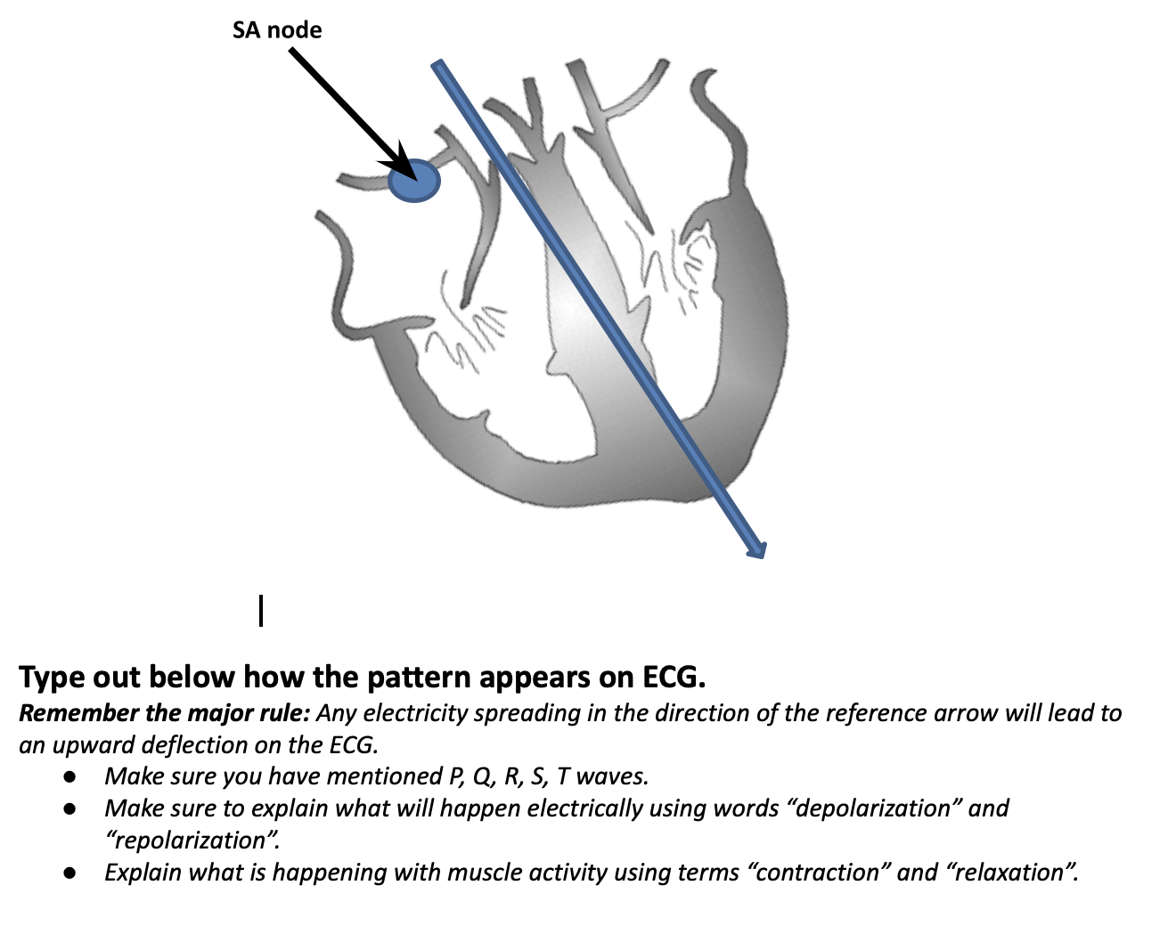 solved-type-out-below-how-the-pattern-appears-on-ecg-chegg