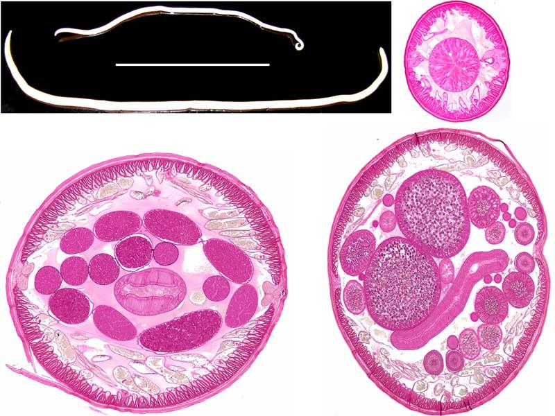 Ascaris Lumbricoides Male And Female Cross Section