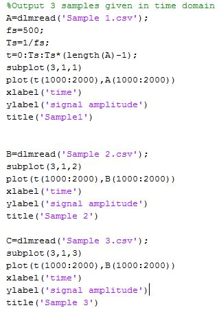 Solved I have 3 ECG files imported to Matlab via csv files | Chegg.com