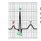 Solved Explain In Your Own Words Why The T Wave In The 