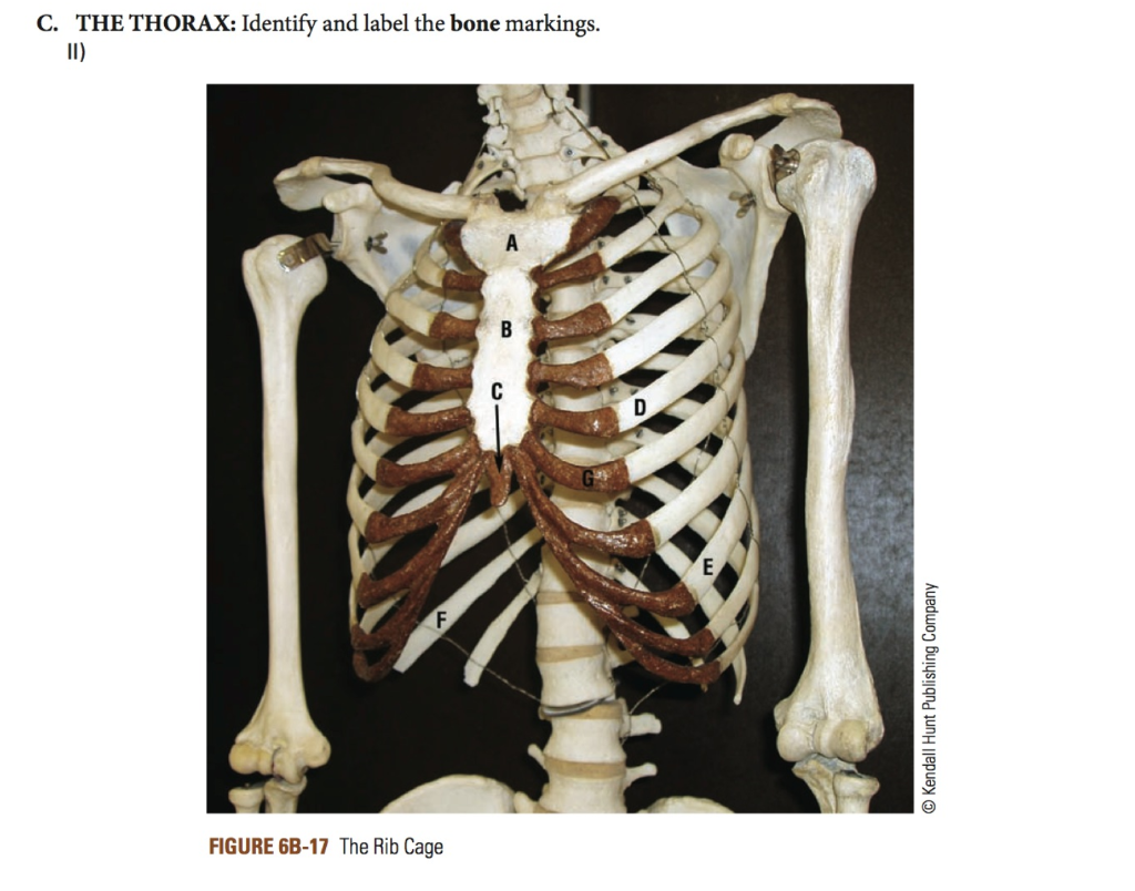 Solved: B. THE VERTEBRA: Identify And Label The Bone Marki... | Chegg.com