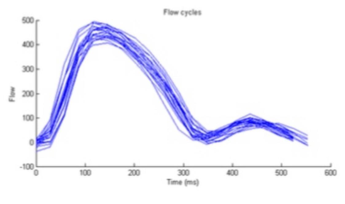 Solved I have to make the graph of the photo in Matlab with | Chegg.com