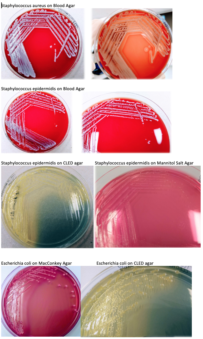 Solved More Microbiology Questions A Name A Bacteria Th Chegg Com