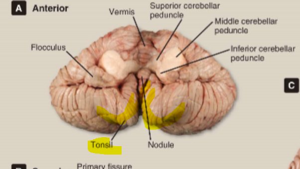 cerebellar vermis tonsils