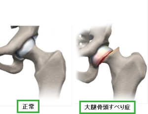 下肢の軟損 Flashcards Chegg Com