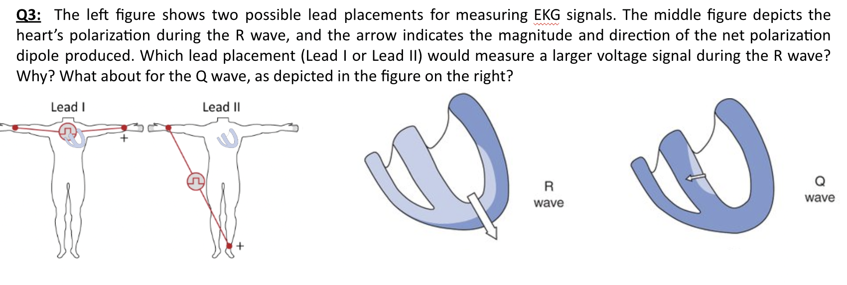 Solved Q3: The left figure shows two possible lead | Chegg.com