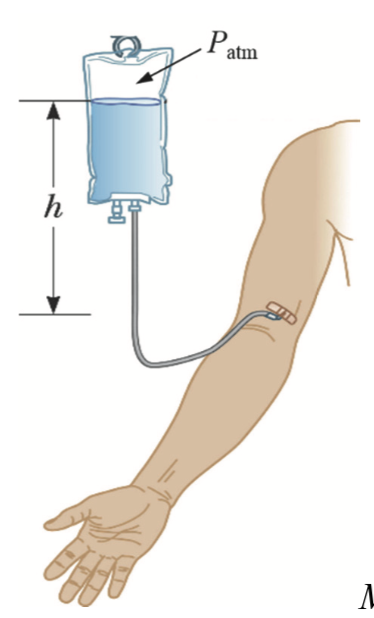 Solved 2. A liquid medicine is injected into a patient from | Chegg.com