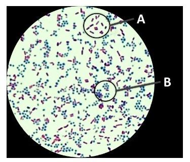 Solved The image pictured is of an Acid-Fast stain | Chegg.com