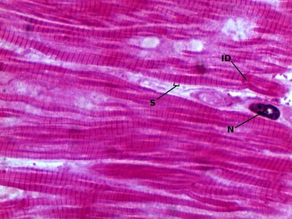 skeletal muscle tissue slide 100x