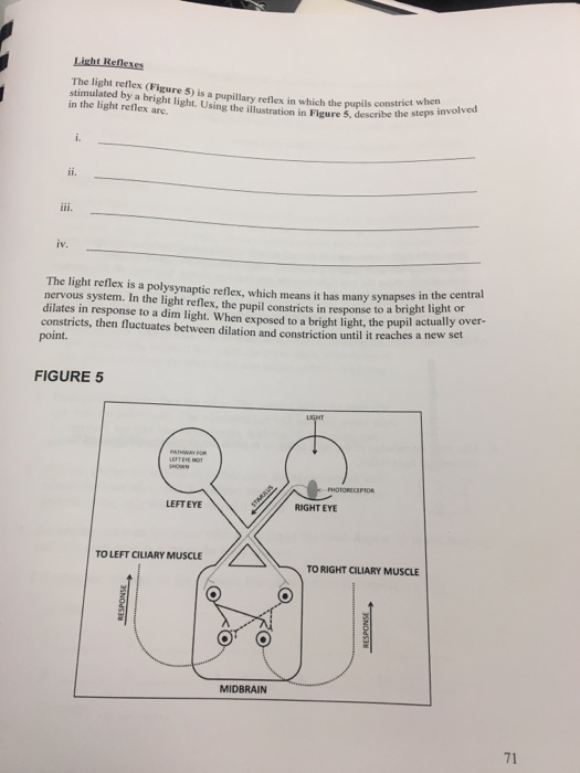 Solved The light reflex (Figure 5) is a pupillary reflex in | Chegg.com