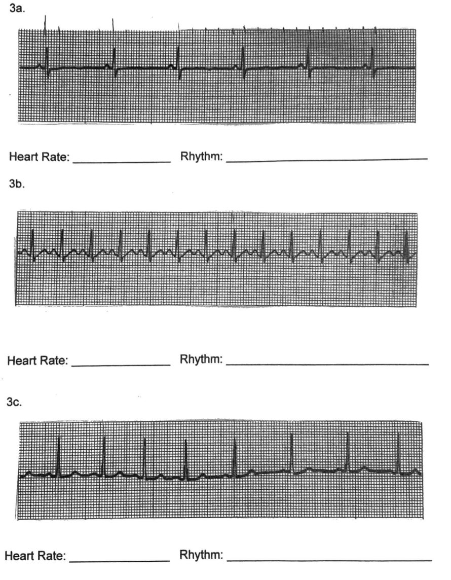 Solved for each of them, find the heart rate and rhythm. | Chegg.com