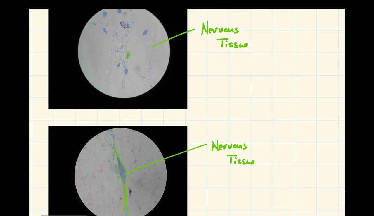 Solved Nervous Tissu Nervous Tissue | Chegg.com