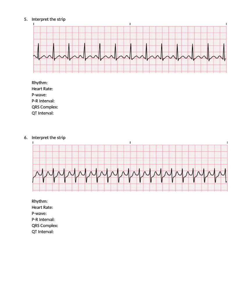 Solved 3. Interpret the strip 4. Rhythm: Heart Rate: P-wave: | Chegg.com