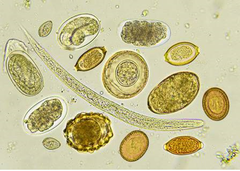 Solved IDENTIFY THE TYPE OF HELMINTH EGGS (EXACT NAME OF THE | Chegg.com
