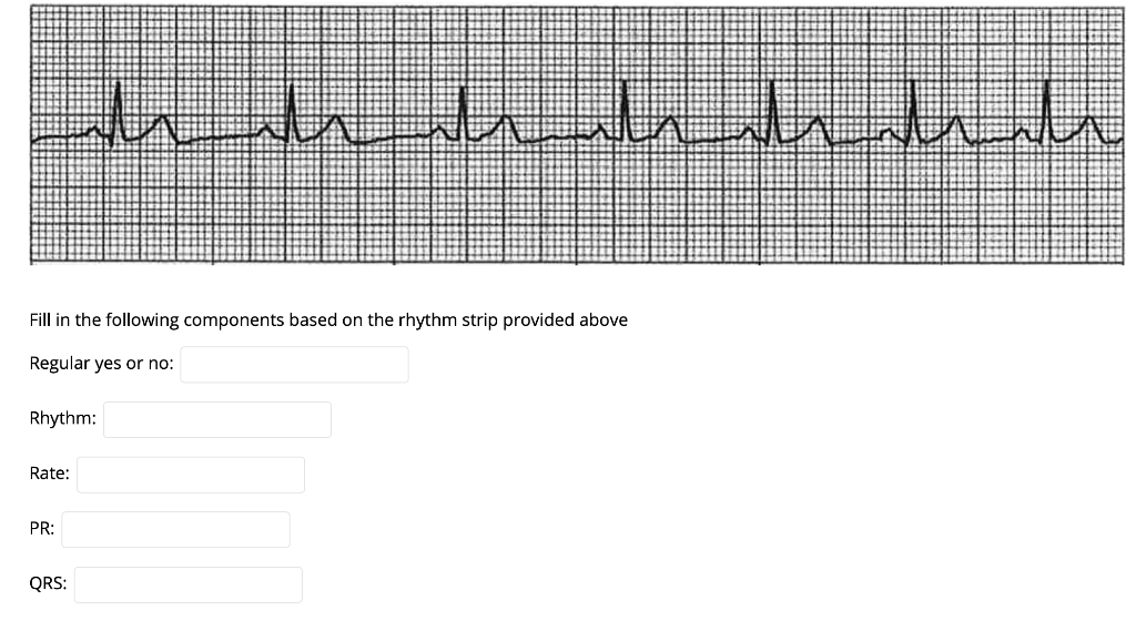 www.hu Fill in the following components based on the rhythm strip provided above Regular yes or no: Rhythm: Rate: PR: QRS: