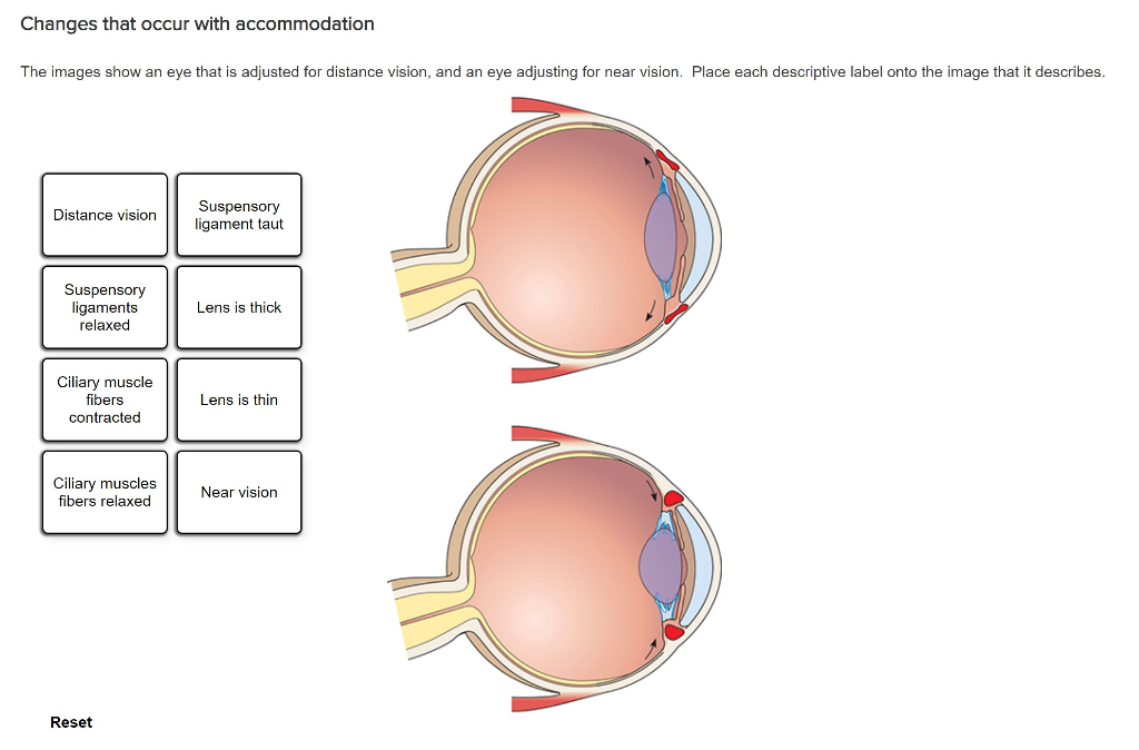 solved-changes-that-occur-with-accommodation-the-images-show-chegg