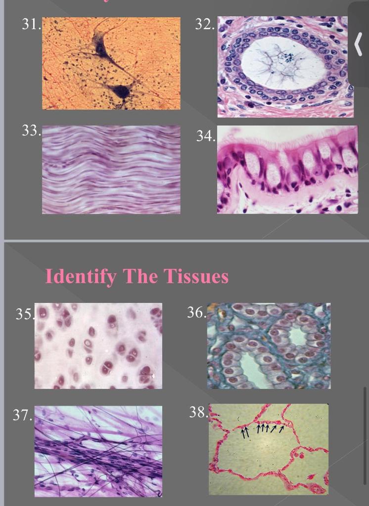 Solved Identify The Tissues 2. 3. Identify The Tissues 16. | Chegg.com