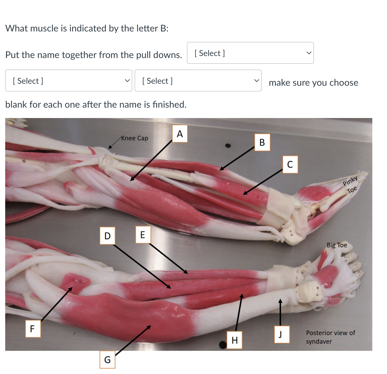 Solved What Muscle Is Indicated By The Letter B: Put The | Chegg.com