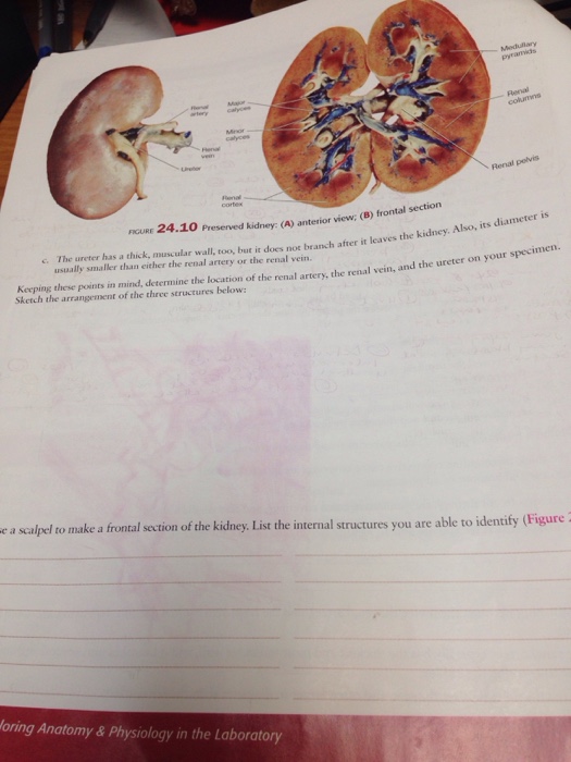 Solved Procedure Kidney Dissection In this exercise you wi