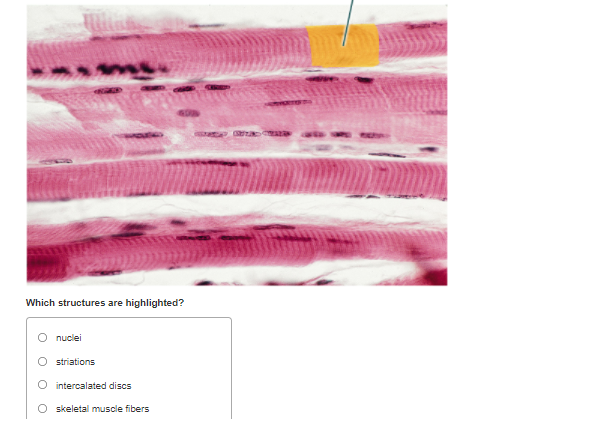 solved-which-structures-are-highlighted-nuclei-o-striations-chegg