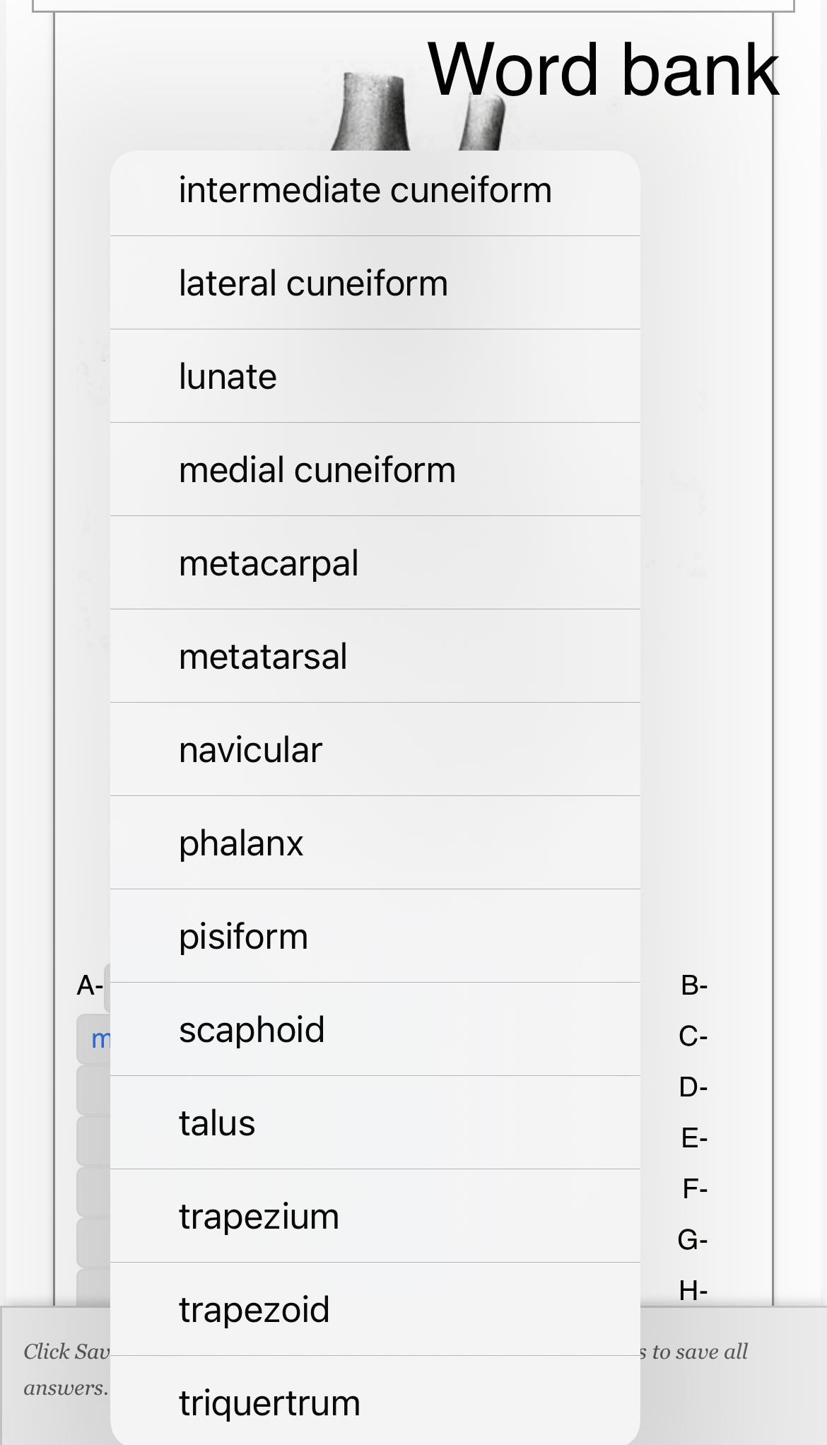 Solved Identify the indicated bones Word bank 1 calcaneus | Chegg.com