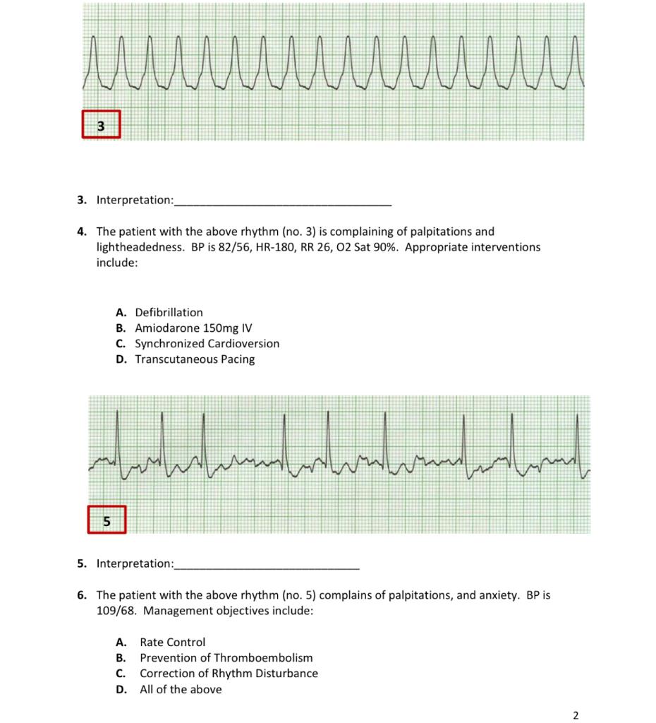 Solved 4. The patient with the above rhythm (no. 3 ) is | Chegg.com