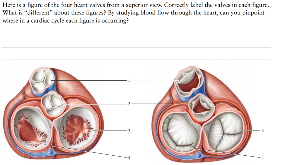 Solved Here Is A Figure Of The Four Heart Valves From A Chegg Com