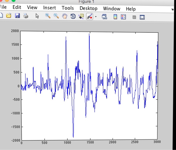 Solved Identify the source of noise artifact in the