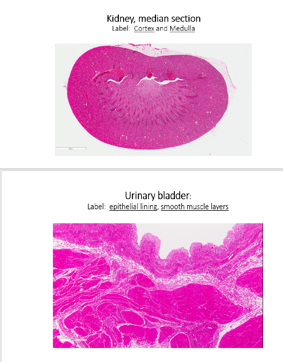 Solved Kidney, median section Label: Cortex and Medulla | Chegg.com