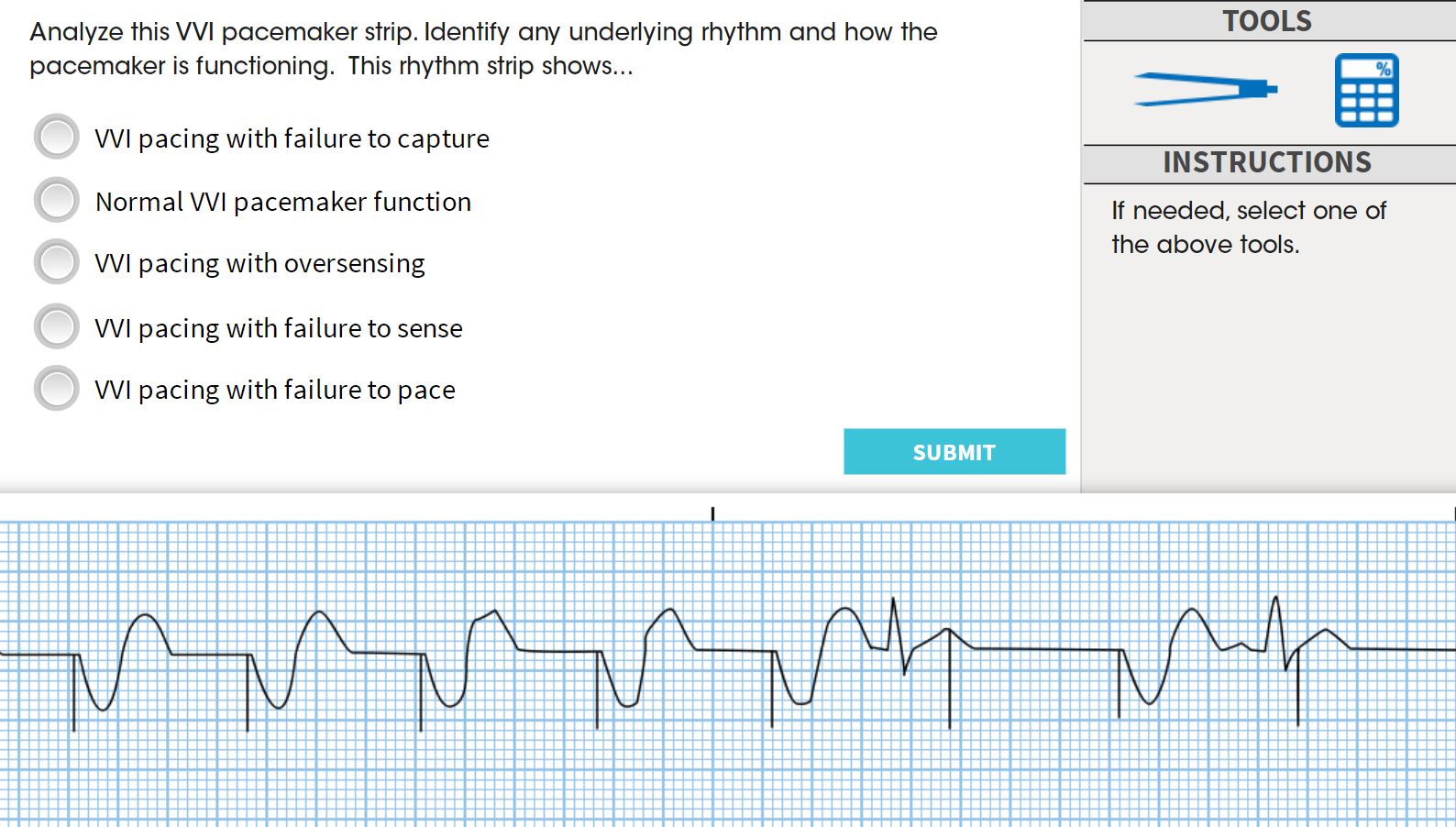 Solved Analyze this VVI pacemaker strip. Identify any | Chegg.com